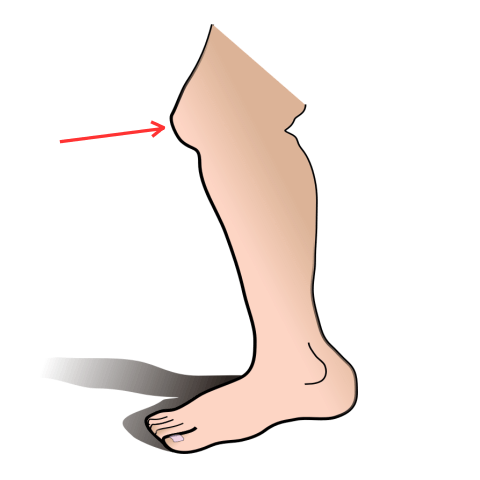 Knee